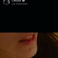 Ceryza Desnuda