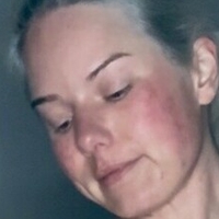 kaepiglet Desnuda